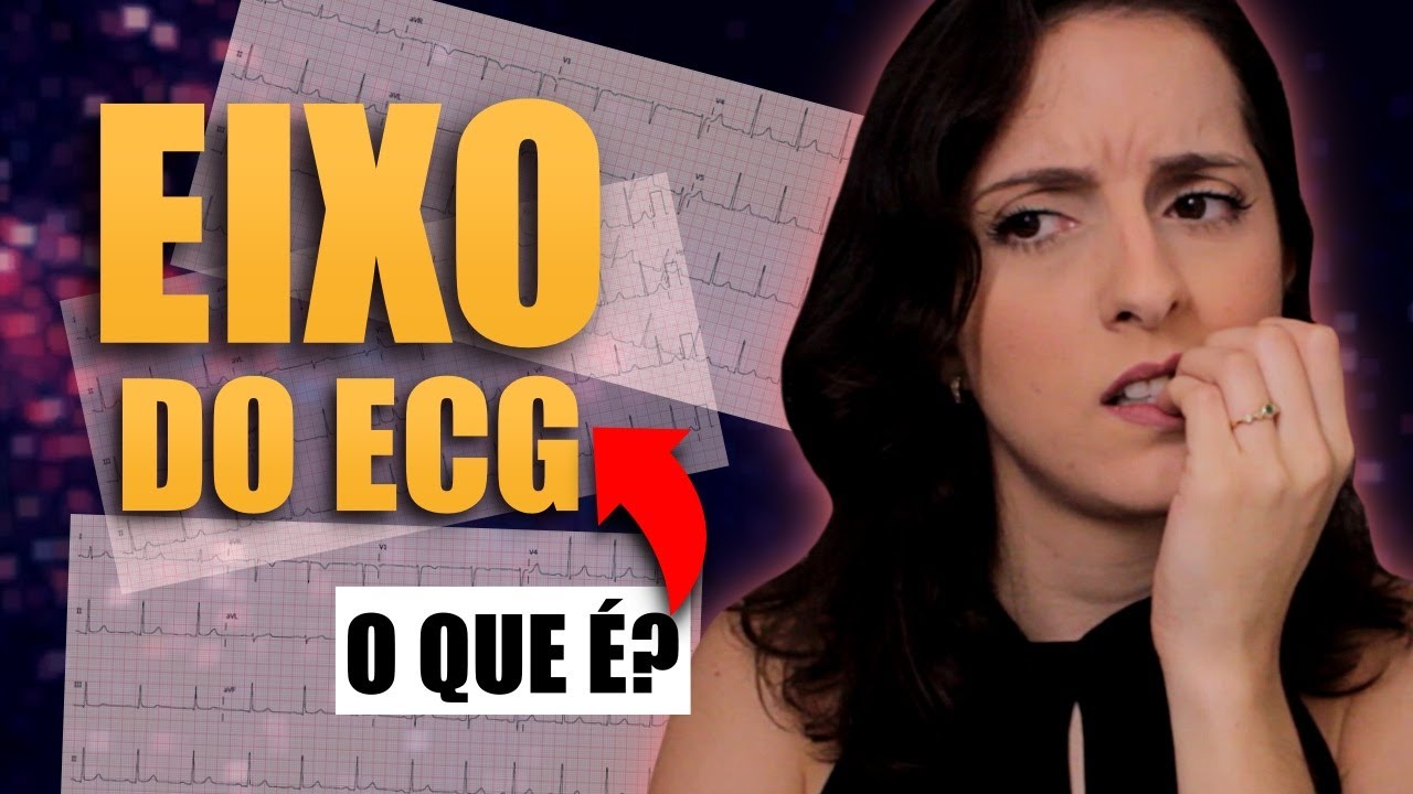 Eixo Elétrico do ECG: O Que é o Eixo do ECG? [ENTENDA de Uma Vez por Todas!]