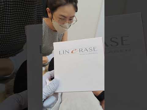 Linerase Collagen Injection | Smooth Wrinkles & Rejuvenate Skin