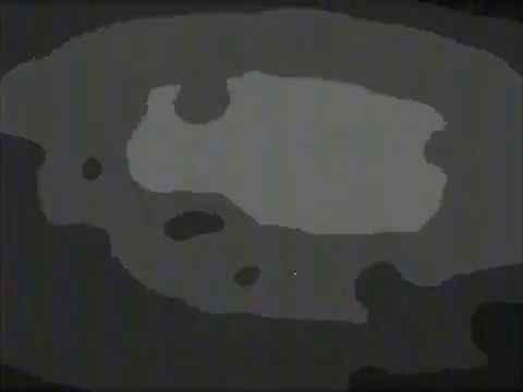 Aeswa - Killer (Darkblack XIII Remix)