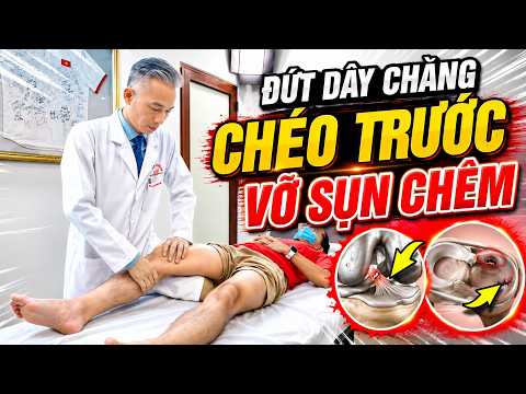 Sai Lầm Đứt ACL, Vỡ Sụn Chêm Khiến Đầu Gối Khó Phục Hồi