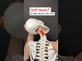 Got a STIFF NECK? Don’t stretch like this! Try this instead! #neckpain #neckpainrelief
