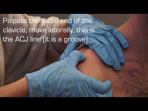 Injection Technique into the Acromioclavicular Joint for OA