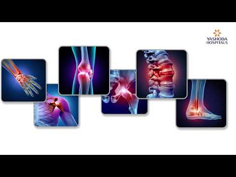 Dr. Deepthi Nandan Reddy - Orthopedic Expert