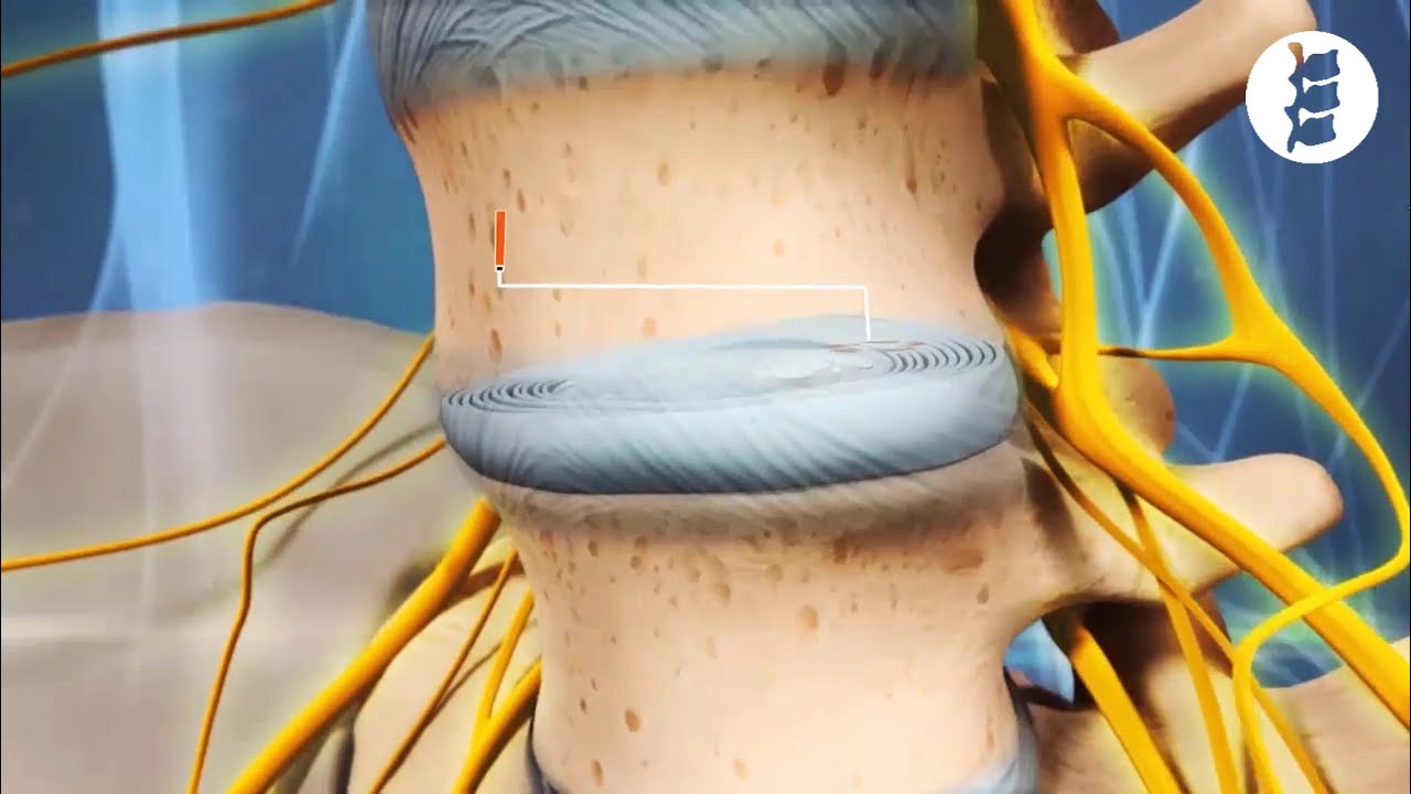 Gunter Munguia Monterroso-27