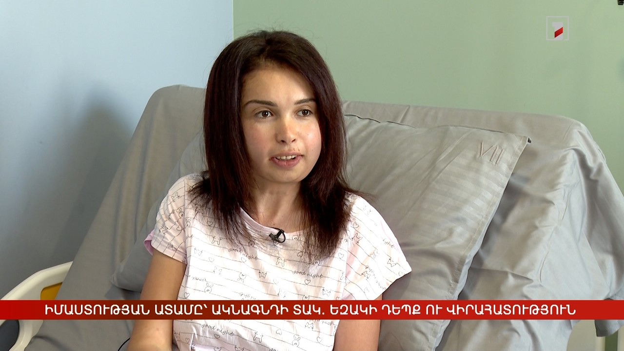 Իմաստության ատամը՝ ակնագնդի տակ. եզակի դեպք ու վիրահատություն