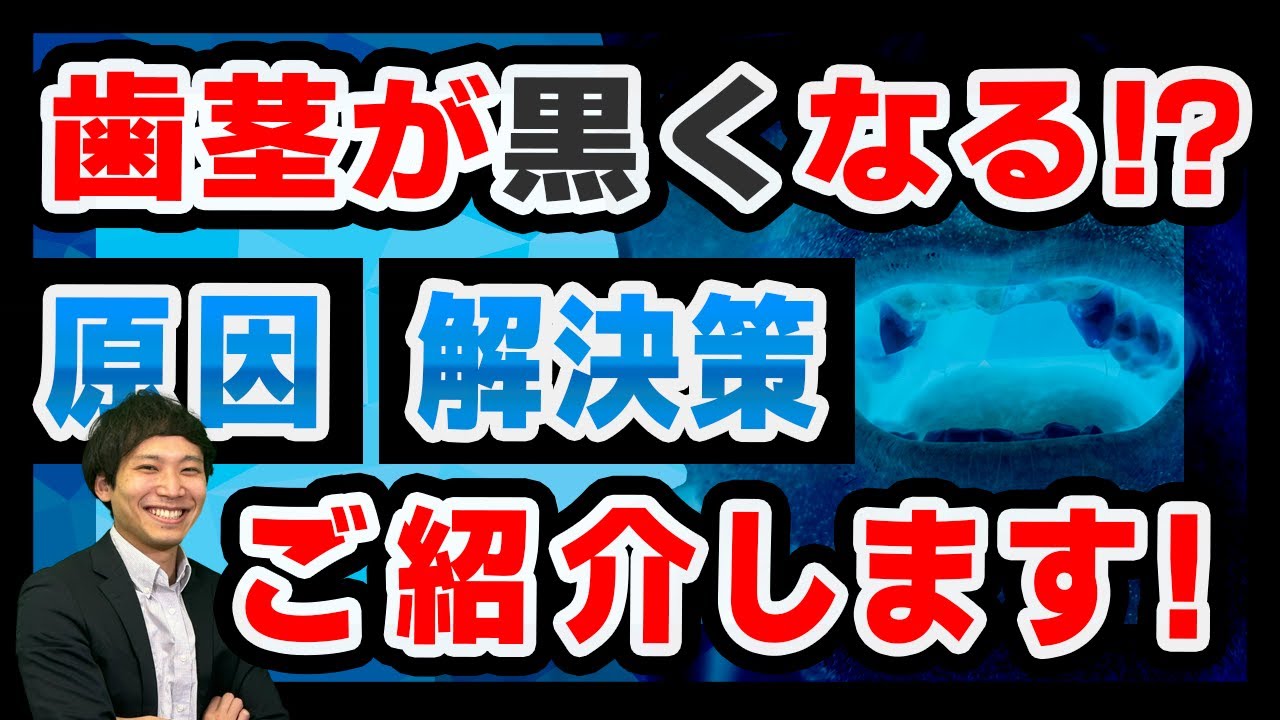 歯茎が黒くなる!?その原因と改善策をご紹介します