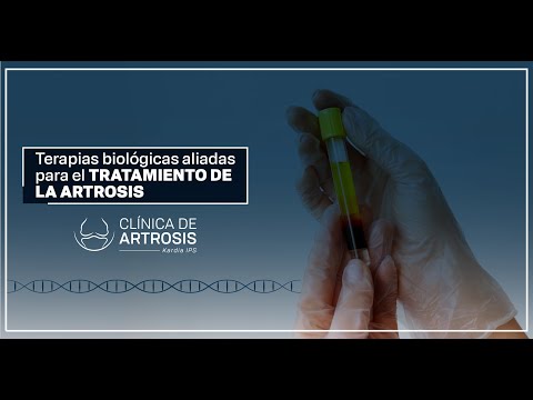 Innovative Biological Therapies for Osteoarthritis Relief in Colombia