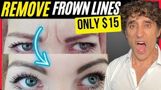 EASILY REMOVE YOUR FROWN LINES AT HOME FOR UNDER $15