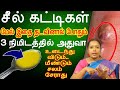 வெயில் காலத்தில் வரும் சீழ் கொப்பளங்