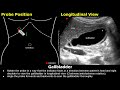 Gallbladder Ultrasound Probe Positioning | Transducer Placement & Scanning | Abdominal USG