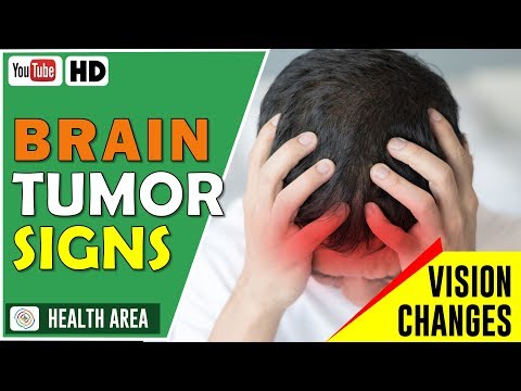 7 Brain Tumor Early Signs and Symptoms Don't Ignore These Video