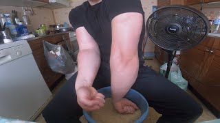 How I blew my forearms with rice (update)