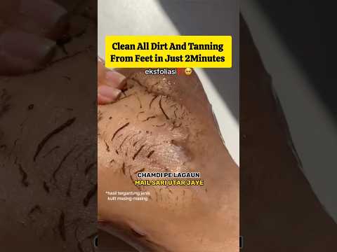 🔥Get Fair Feet in 5Minutes/Remove Suntan Easily At Home/Easy pedicure#skincare #shorts #viralvideo