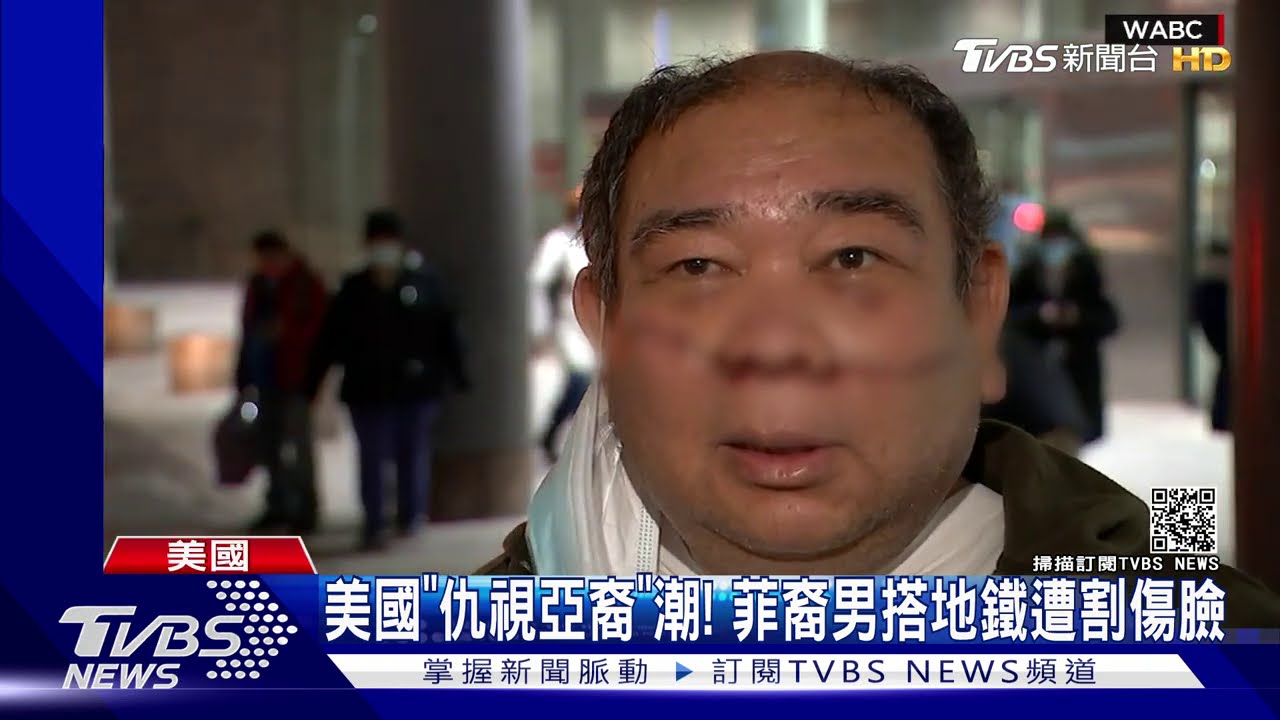 美國「仇視亞裔」潮! 菲裔男搭地鐵遭割傷臉