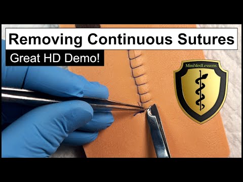 SUTURE Tutorial: How to Remove Continuous Sutures - Best Practices!