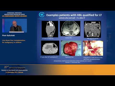 Piotr KALICINSKI. Live donor liver transplantation for malignancy in children