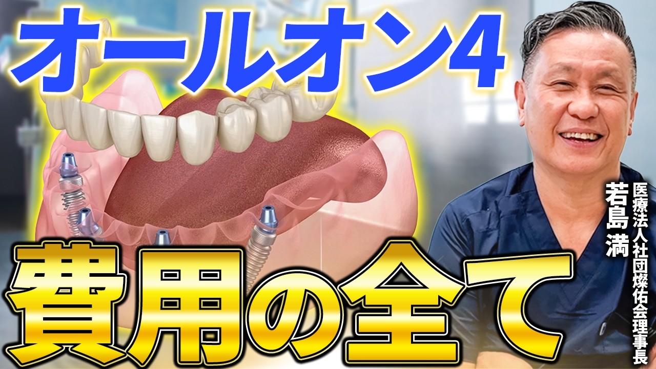 【オールオン4】費用の内訳を歯医者が徹底解説！追加料金で後悔しないためのチェックポイント。