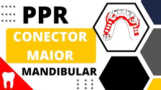 CONECTOR MAIOR MANDIBULAR