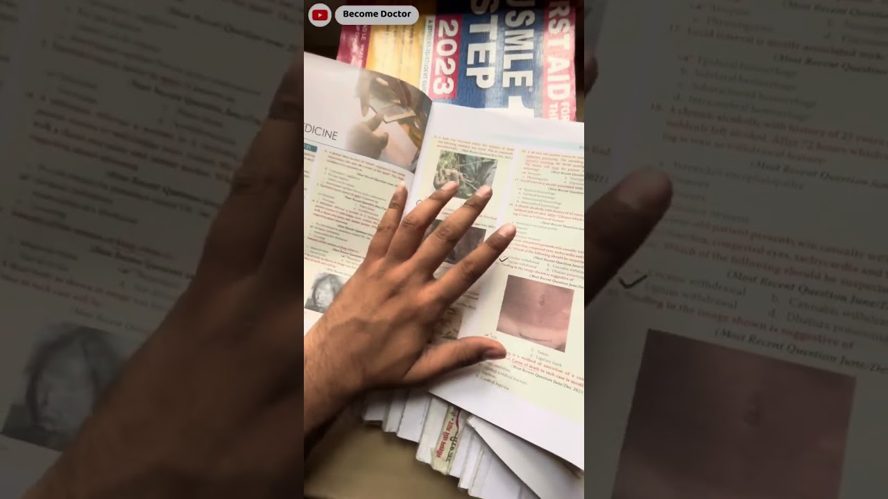 HOW TO STUDY FMGE SOLUTION | How to prepare for Fmge from Fmge solution |@Dr Marwah LIVE