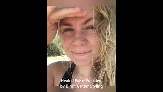 Healed Fake-Freckles | Sommersprossen Permanentmakeup by Birgit Getter Styling Düsseldorf #freckles