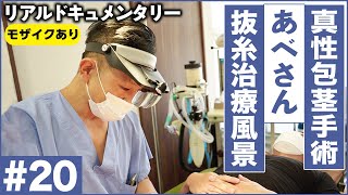 【生の感想】真性包茎手術のリアル抜糸風景！手術前との比較あり！