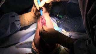 Miniature de la vidéo