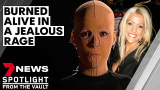 The girl behind the mask: set alight in a jealous rage and scarred for life | 7NEWS Spotlight