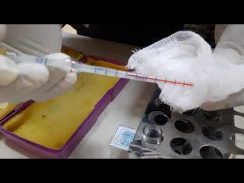 Y1B1:RBC PIPETTE FILLING,MIXING AND CHARGING OF NEUBAUR SLIDE