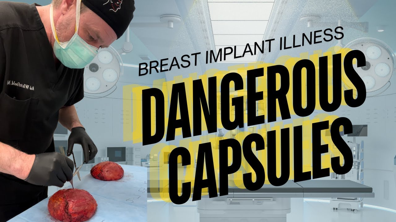 Capsular Contracture: Causes, Grades, and Treatment Options