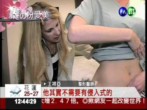 整形雕塑身形 抽脂.溶脂如何選擇?