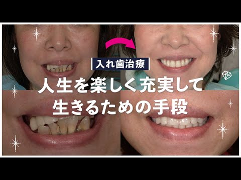 入れ歯治療は人生を楽しく充実して生きるための手段