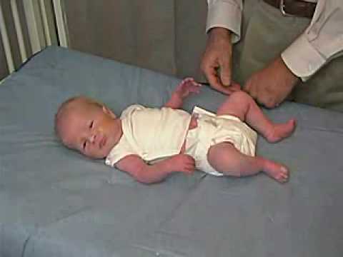neurology exam: newborn-abnormal: Tone - Leg Recoil