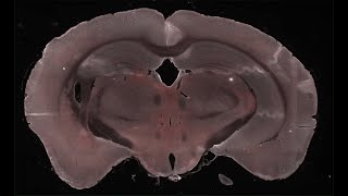 Neuroimmunologist Tom Haran (Get to Know a Scientist!)