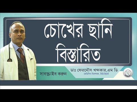 চোখের ছানি--ঘাবড়ানোর কিছু নেই II Drferdousny