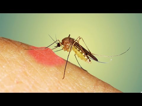 Pse mushkonjat zgjedhin disa persona për t’i ‘sulmuar’?