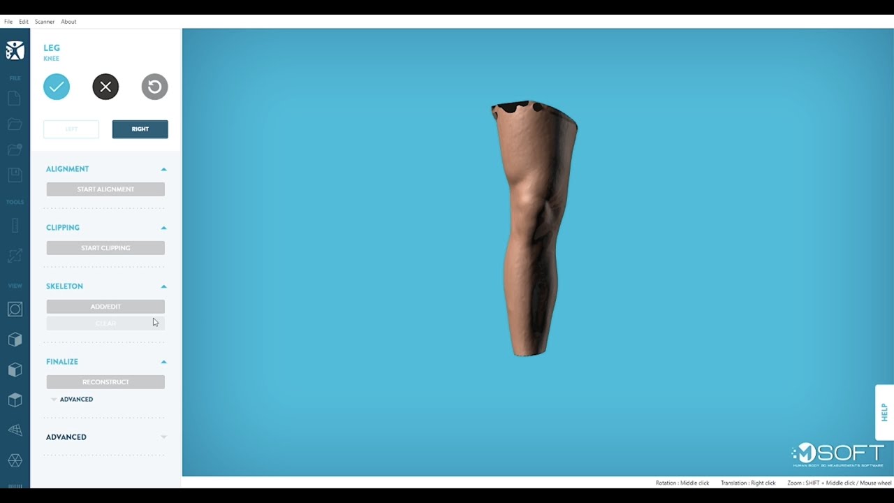 Knee scan processing in MSoft