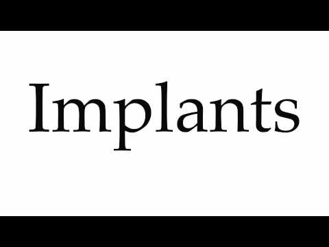 How to Pronounce Implants
