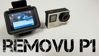 Removu P1