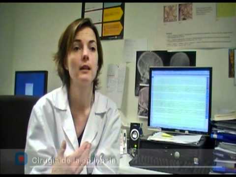 Qué es la epilepsia