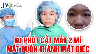 20 năm sống kiếp THIẾU NỮ U SẦU vì MẮT MÍ LÓT, cô gái được JW Cắt mắt 2 mí thành HOTGIRL MẮT BIẾC