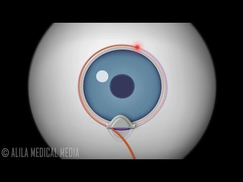 Vision Anatomy and Physiology Animation