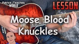 Mooseblood-Knuckles-Guitar Lesson-Tutorial-How to Play-Easy
