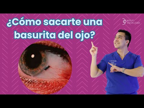 ¿Cómo me saco una basurita del ojo?