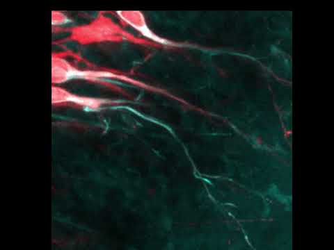 Nine day old baby neurons growing thumbnail