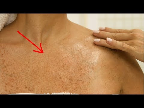 Как приготовить маску для лица отбеливающую Веснушки у мужчины