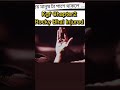 Rocky Bhai Very Injured Kgf Chapter2 Emotional Scene Shorts Kgf Rocky Trending