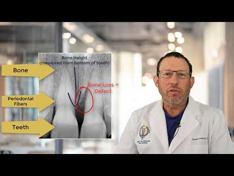 What dentists are looking at in your x-ray