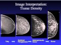 Introduction To Mammography