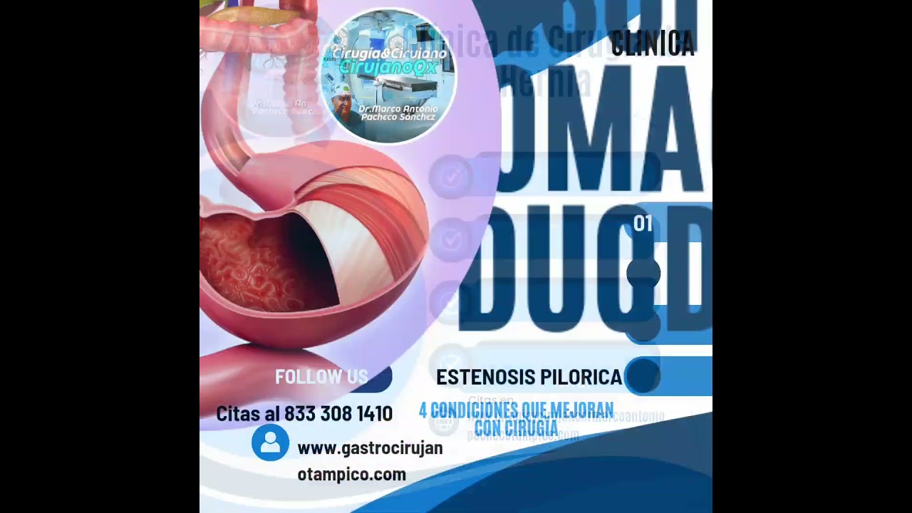 Marco Antonio Pacheco Sánchez-24