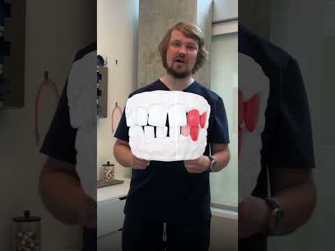 Why you take 360º CBCT X-rays | Impress